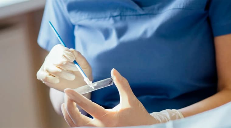 Papanicolaou (citología cervical)