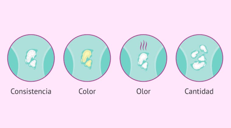 Flujo vaginal anormal